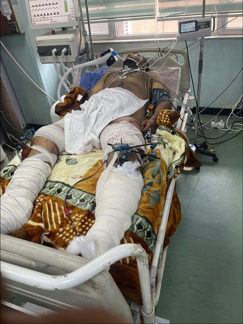 صورة محمد مظفر مهدي - سائق توصيل في شركة طلبات يرقد في المستشفى قبل وفاته 