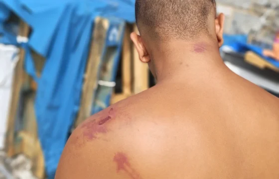 حقوقيون يتهمون السلطات الإسبانية بتعذيب مهاجرين في سبتة
